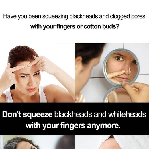 Blackhead Tweezers